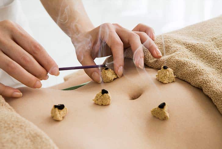 Moxa cautery oriental medicine in Korea