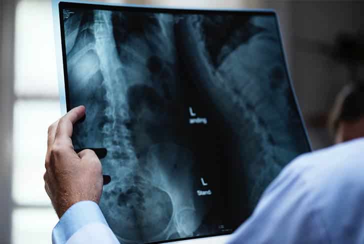 X-ray before internal medicine treatment